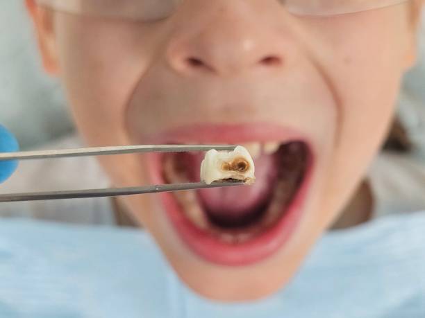 Best Emergency Treatment for Jaw Pain or Injury in Warrenton, MO